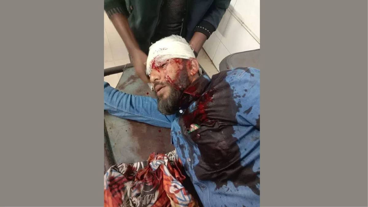 এবার খুলনায় এনসিপি নেতাকে গুলি