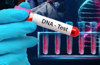 ডিএনএ পরীক্ষায় অন্তরায় পলাতক আসামি